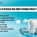 https://lenoxinstruments.com/2025/06/18/understanding-the-silent-damage-of-bruxism-and-dental-health/