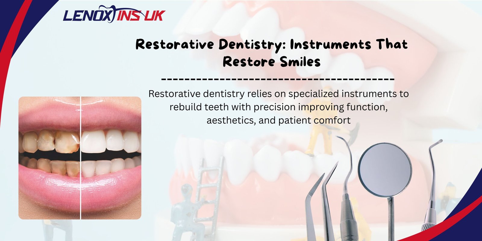Composite restorative dental instruments for filling and smile correction