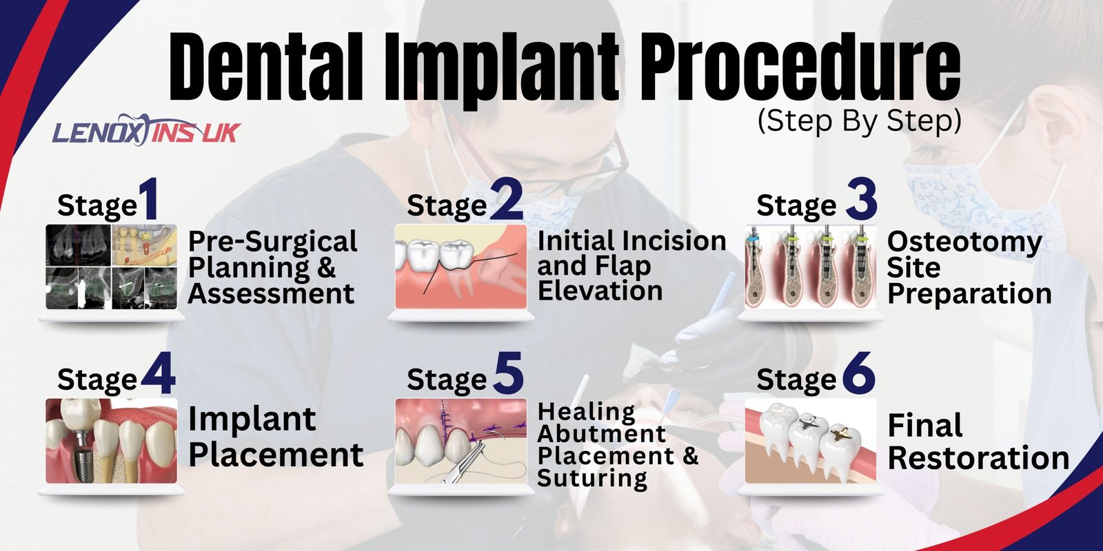 Step-by-Step Dental Implant Procedure Tools