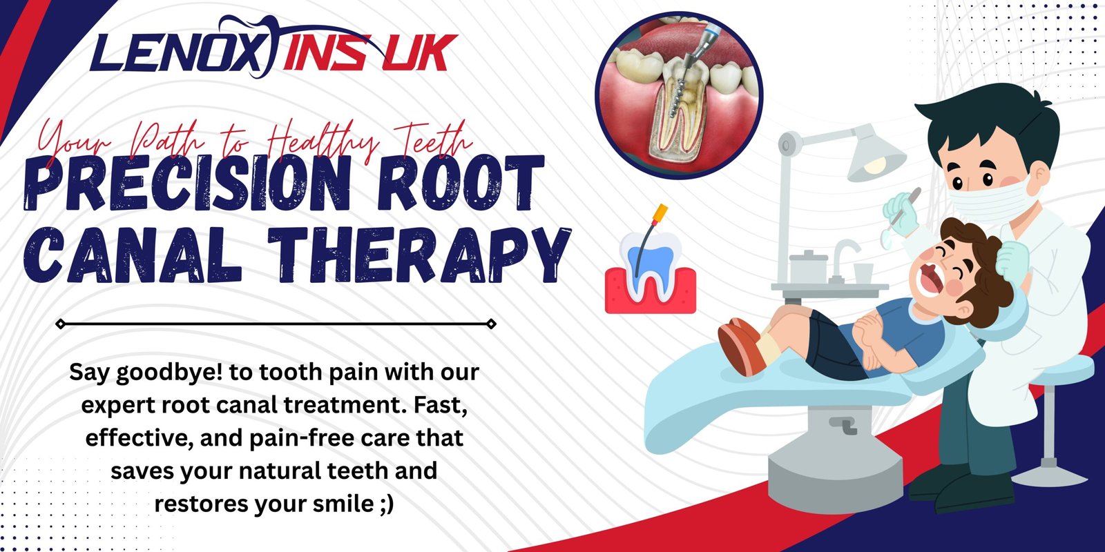 Root Canal Treatment to Save Tooth